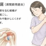 【名古屋市瑞穂区・鍼灸】左五十肩・夜間痛の改善事例|中澤治療院